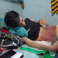 Berjuang dengan Perlengketan Usus, Pemuda Asal Banjarmasin Hanya Ingin Bisa Makan Tanpa Rasa Sakit WhatsApp Image 2025-10-12 at 14.25.06